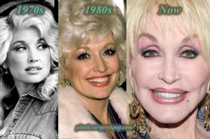 DollyPartonPlasticSurgery